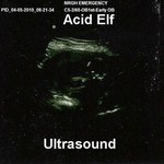 cover: Acid Elf - Ultrasound